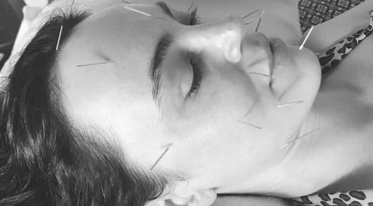 Facial acupuncture - from Thailand